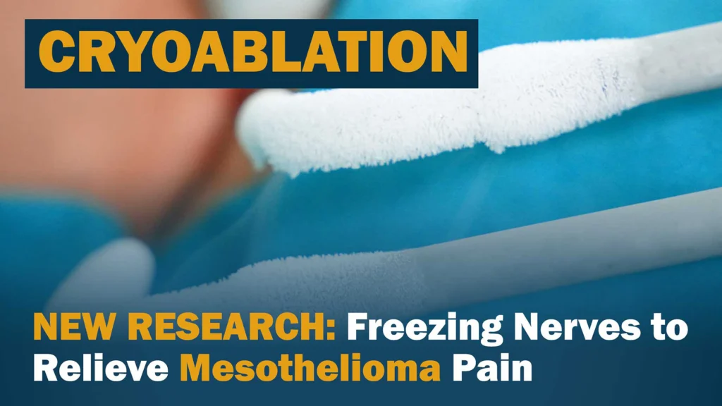 Freezing Nerves to Relieve Mesothelioma Pain: What New Research Reveals
