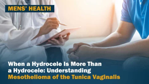 When a Hydrocele Is More Than a Hydrocele: Understanding Testicular Mesothelioma