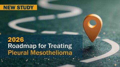 Roadmap for Treating Pleural Mesothelioma: New Expert Consensus